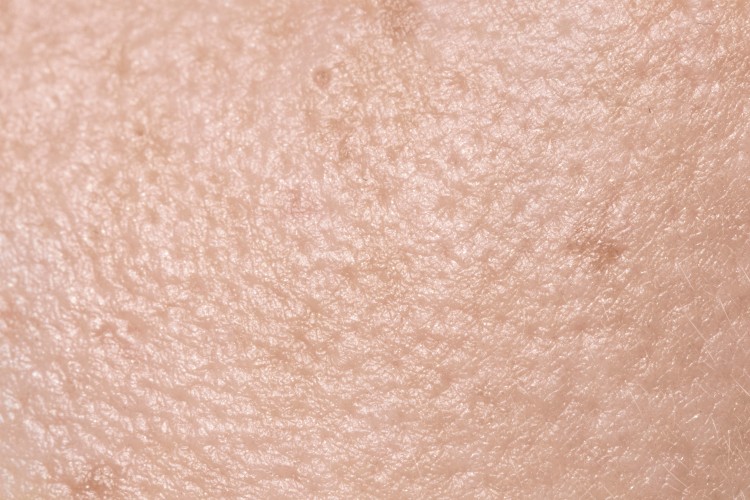 Trigger Pattern Skin Can HOCl Trigger a Skin Purge?-Shine HOCl