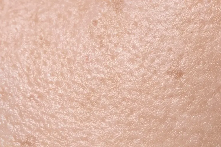 ¿Puede el HOCl provocar una purga de la piel?