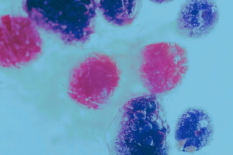 Where in the Body Does Hypochlorous Acid Come From?