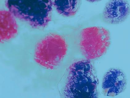 Where in the Body Does Hypochlorous Acid Come From?