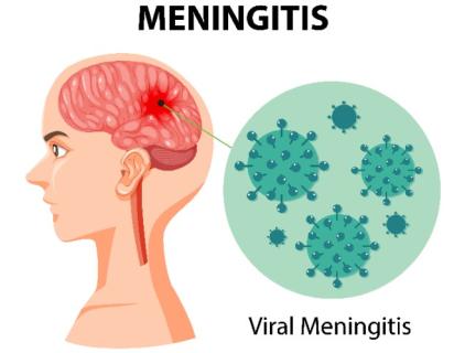 HOCl vs Meningitis Outbreak